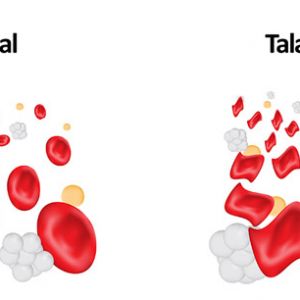 Thalassemia (Mediterranean Anemia) Test